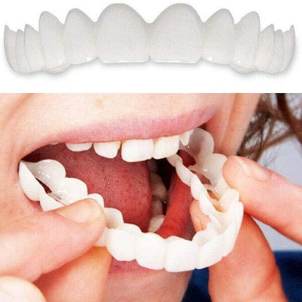 Lente de Contato Dental Removível Inferior e Superior
